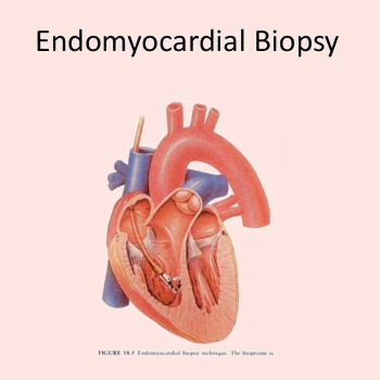 RIGHT VENTRICULAR BIOPSY (OR) ENDOMYOCARDIAL BIOPSY