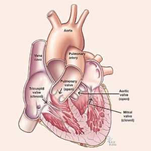 HEART VALVE PROBLEMS img2
