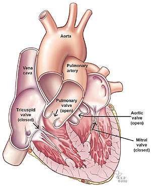 valvular heart disease