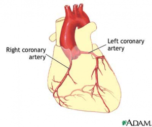 Angiogram 1