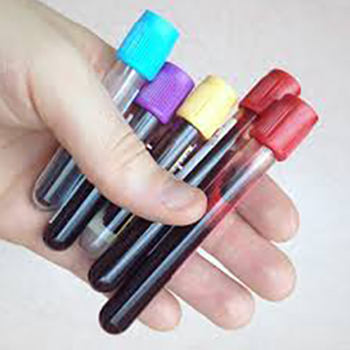 BLOOD TEST (CARDIAC ENZYME)