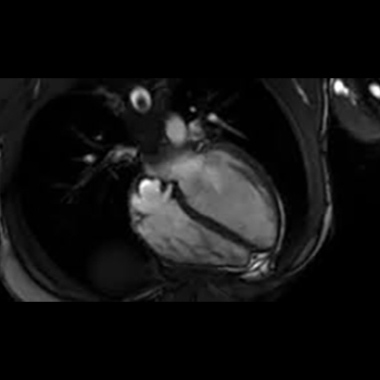 CARDIAC MRI (MAGNETIC RESONANCE IMAGING)