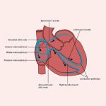 EP testing (Electrophysiological test)